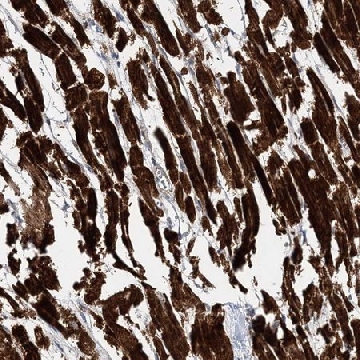 Anti-NBAS antibody produced in rabbit，100UL，HPA036817-100UL，Sigma