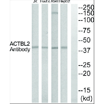 Anti-ACTBL2 antibody produced in rabbit，100UL，SAB4301133-100UL，Sigma