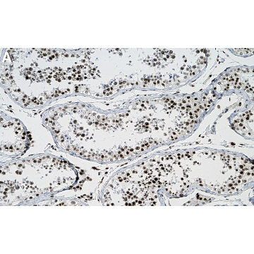 Anti-TRIP12 Antibody, clone 2H6 ZooMAb® Rabbit Monoclonal，25UL，ZRB2091-25UL，Sigma