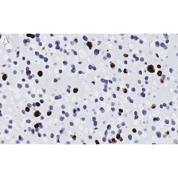 Anti-Adenovirus Antibody, clone 20/11 ZooMAb® Mouse Monoclonal，4X25UL，ZMS1110-4X25UL，Sigma
