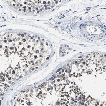 Anti-STRBP antibody produced in rabbit，100UL，HPA020651-100UL，Sigma