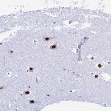 Anti-RNPS1 antibody produced in rabbit，100UL，HPA044014-100UL，Sigma