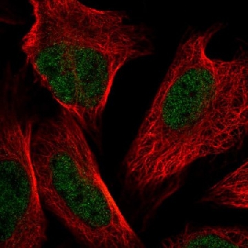 Anti-NSMCE4A antibody produced in rabbit，100UL，HPA044872-100UL，Sigma