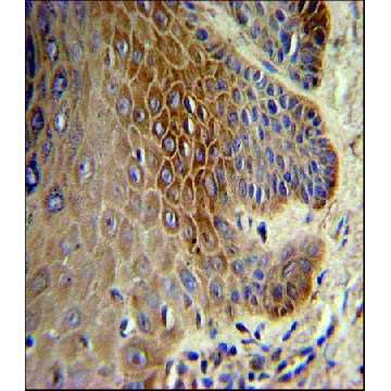 ANTI-COL17A1 (CENTER) antibody produced in rabbit，400UL，SAB1303199-400UL，Sigma