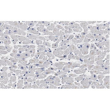Anti-Cardiac Troponin I Antibody, clone 1F23, ZooMAb® Rabbit Monoclonal，4X25UL，ZRB1355-4X25UL，Sigma