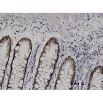 Monoclonal Anti-HOXD11, (N-terminal) antibody produced in mouse，100UG，SAB1403944-100UG，Sigma
