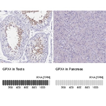 Anti-GPX4 antibody produced in rabbit，100UL，HPA058546-100UL，Sigma