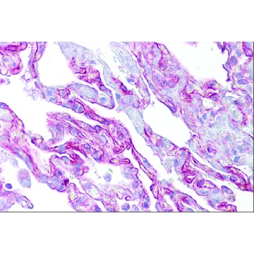 Anti-PTHLH antibody produced in rabbit，100UL，SAB2106317-100UL，Sigma