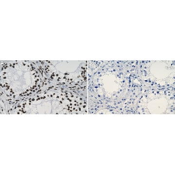 Anti-PAX7 Antibody, clone 2D12 ZooMAb® Rabbit Monoclonal，4X25UL，ZRB2345-4X25UL，Sigma