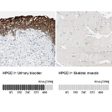 Anti-HPGD antibody produced in rabbit，100UL，HPA005679-100UL，Sigma