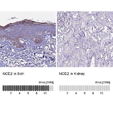 Anti-NOD2 antibody produced in rabbit，100UL，HPA041985-100UL，Sigma