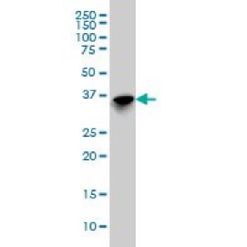 Monoclonal Anti-SFTPD antibody produced in mouse，100UG，WH0006441M1-100UG，Sigma