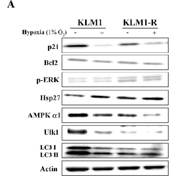 Anti-ULK1 antibody produced in rabbit，200UL，SAB4200106-200UL，Sigma