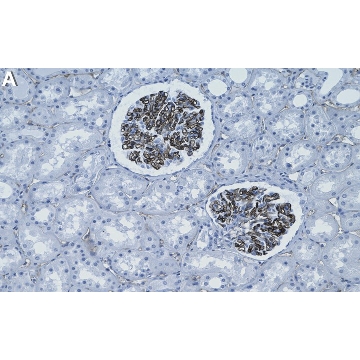 Anti-Mucin-14/EMCN Antibody, clone 1E8 ZooMAb® Rabbit Monoclonal，25UL，ZRB2292-25UL，Sigma