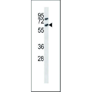 ANTI-MOUSE ACVR1C (C-TERM) antibody produced in rabbit，400UL，SAB1302021-400UL，Sigma
