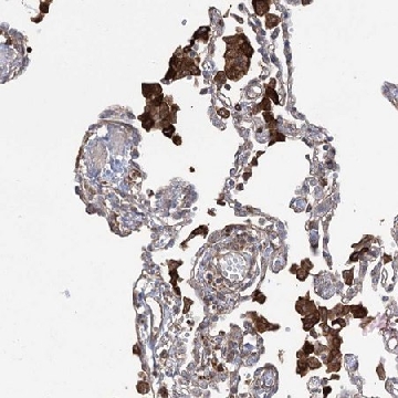 Anti-OTUD1 antibody produced in rabbit，100UL，HPA038504-100UL，Sigma
