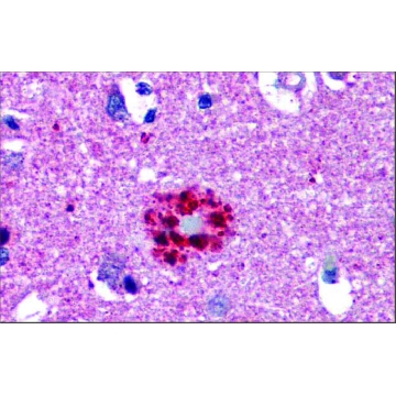 Anti-TCF21 antibody produced in rabbit，100UL，AV33421-100UL，Sigma