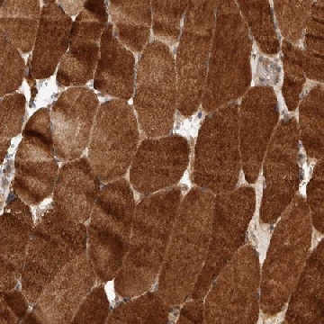 Anti-PRDM15 antibody produced in rabbit，100UL，HPA024268-100UL，Sigma