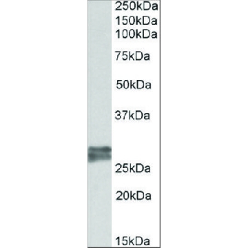 Anti-TNNI3 antibody produced in goat，100UG，SAB2502170-100UG，Sigma