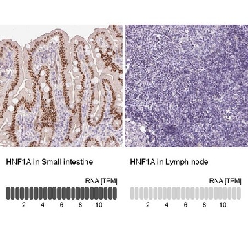 抗-HNF1A 兔抗，100UL，HPA035231-100UL，Sigma