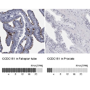 Anti-CCDC181 antibody produced in rabbit，100UL，HPA027312-100UL，Sigma