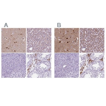 Anti-APOE antibody produced in rabbit，100UL，HPA065539-100UL，Sigma