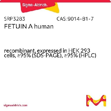 人胎球蛋白 A，50UG，SRP3283-50UG，Sigma