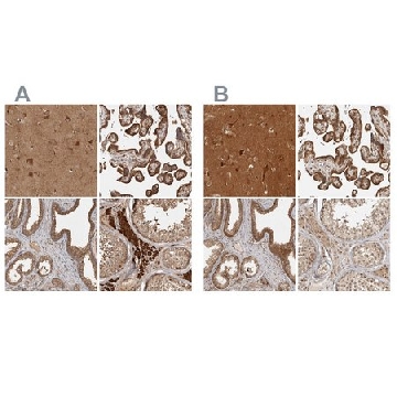 Anti-CAMSAP2 antibody produced in rabbit，100UL，HPA027302-100UL，Sigma