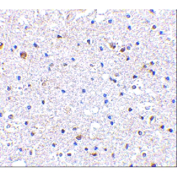 抗PD-1 (ab1) 兔抗，100UG，PRS4065-100UG，Sigma