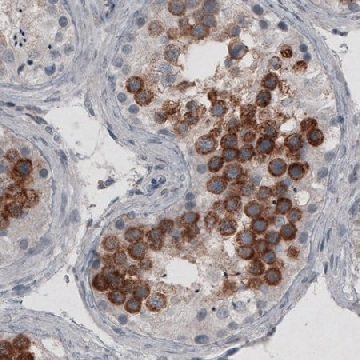 Monoclonal Anti-LY6K antibody produced in mouse，100UL，AMAB90986-100UL，Sigma