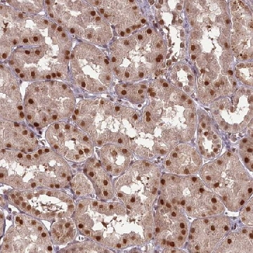 Anti-CEP83 antibody produced in rabbit，100UL，HPA038161-100UL，Sigma