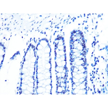 Anti-U2AF2/U2AF65 Antibody, clone 8E8R9, Rabbit Monoclonal，100UL，SAB5702477-100UL，Sigma