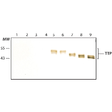 Anti-TTP (N-terminal) antibody produced in rabbit，200UL，T5327-200UL，Sigma
