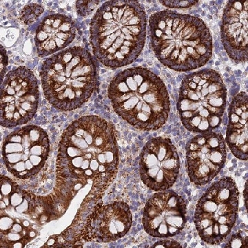 Anti-CSPG4 antibody produced in rabbit，100UL，HPA042785-100UL，Sigma