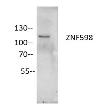 Anti-ZNF598 Antibody, clone 3N7, ZooMAb® Rabbit Monoclonal，25UL，ZRB1353-25UL，Sigma