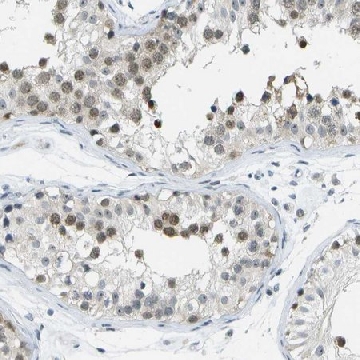 Anti-PITHD1 antibody produced in rabbit，100UL，HPA016936-100UL，Sigma
