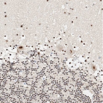Anti-SON antibody produced in rabbit，100UL，HPA023535-100UL，Sigma