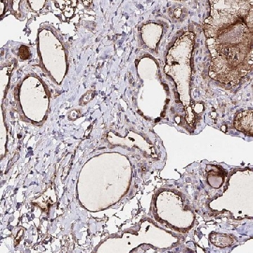 Anti-FBXO34 antibody produced in rabbit，100UL，HPA052592-100UL，Sigma