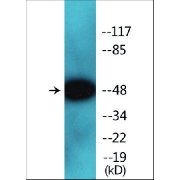 抗-磷酸化-Smad2/3 (pThr⁸) 兔抗，100UG，SAB4504208-100UG，Sigma