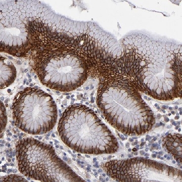 ANTI-EXD2 antibody produced in rabbit，100UL，HPA002906-100UL，Sigma