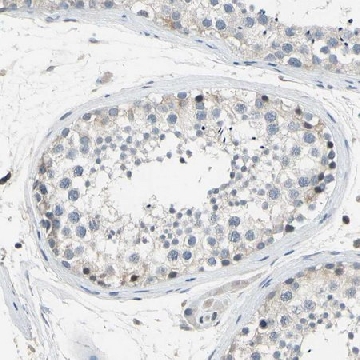 Anti-LHX9 antibody produced in rabbit，100UL，HPA009695-100UL，Sigma