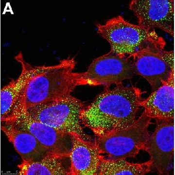 Anti-PIEZO2 Antibody, clone 1H10 ZooMAb® Rabbit Monoclonal，4X25UL，ZRB1468-4X25UL，Sigma