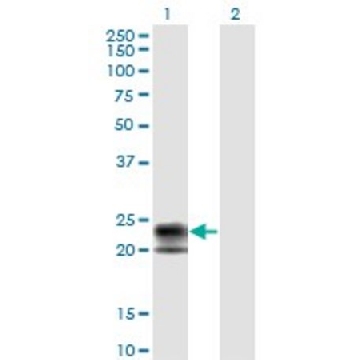 Monoclonal Anti-TNFRSF17 antibody produced in mouse，100UG，WH0000608M1-100UG，Sigma