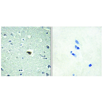 Anti-BAI1 antibody produced in rabbit，100UG，SAB4502506-100UG，Sigma