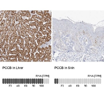 Anti-PCCB antibody produced in rabbit，100UL，HPA036940-100UL，Sigma