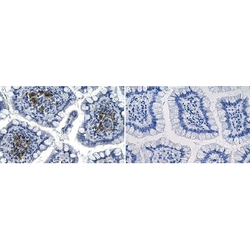 Anti-RANKL/TNFSF11 Antibody, clone 1H17 ZooMAb® Rabbit Monoclonal，4X25UL，ZRB2275-4X25UL，Sigma