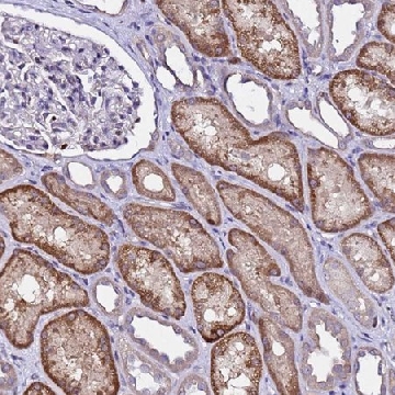 Anti-ALG3 antibody produced in rabbit，100UL，HPA045103-100UL，Sigma