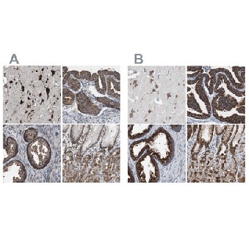 Anti-USP10 antibody produced in rabbit，100UL，HPA006731-100UL，Sigma