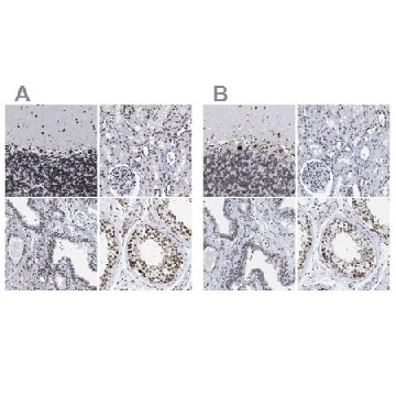 Anti-TPR antibody produced in rabbit，100UL，HPA019661-100UL，Sigma