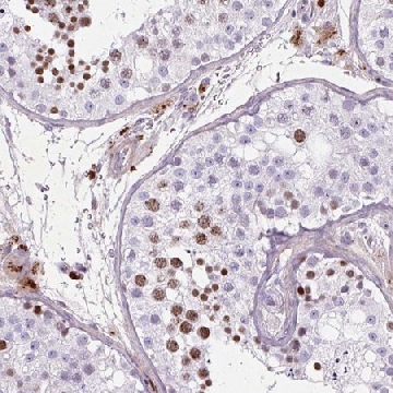 Anti-SPC24 antibody produced in rabbit，100UL，HPA051234-100UL，Sigma